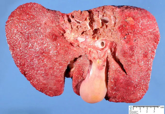 Centre Ibn Rochd - Laboratoire d'Anatomie Pathologique 9